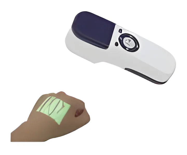 Vein Finder, neonatology equipment