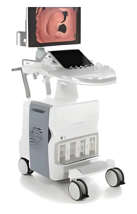 Gynecology Ultrasound, gynecology equipment