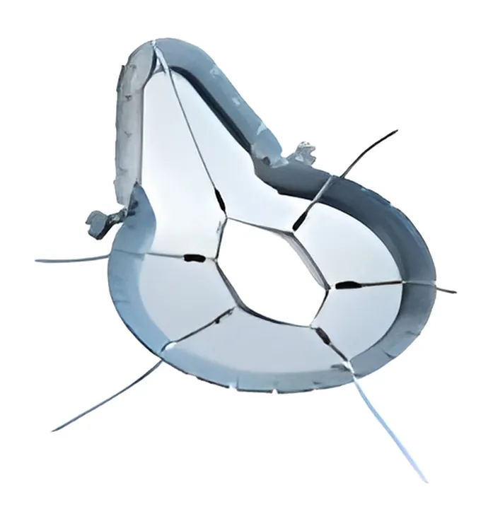 Elastic Retraction System, gynecology equipment