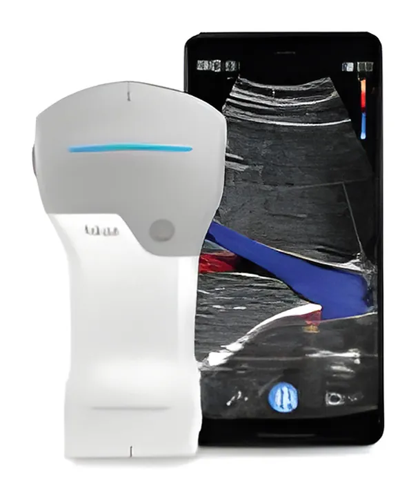 Wireless Ultrasound, ultrasound equipment